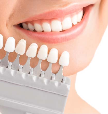 In chair teeth whitening